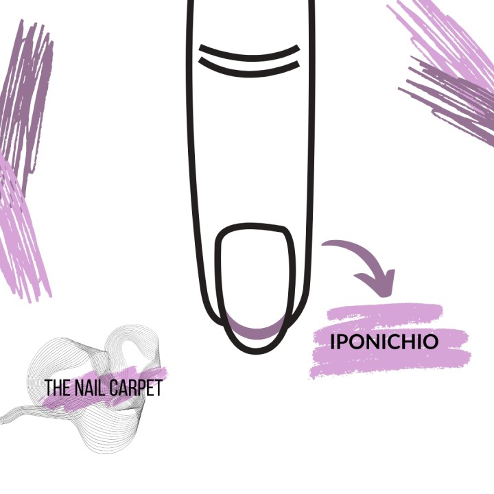 IPONICHIO